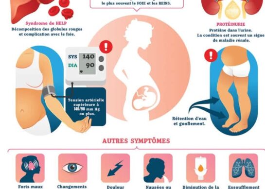 La prééclampsie chez la femme enceinte